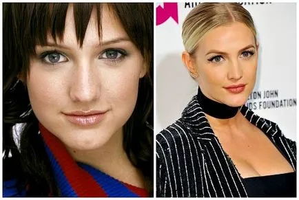 Ashlee Simpson, înainte și după fotografii și video de chirurgie plastica