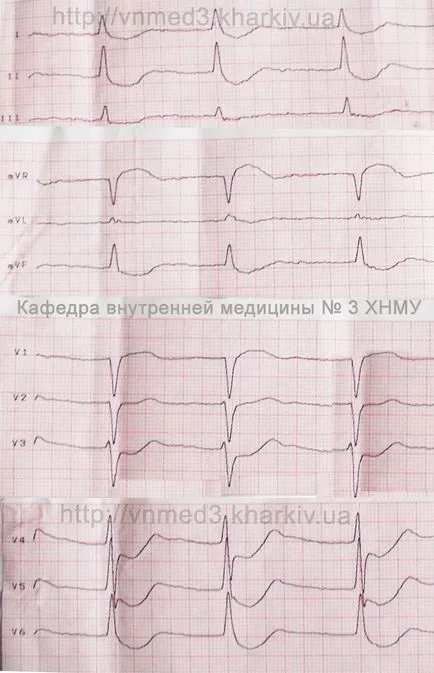 ECG de supradozaj glicozide cardiace, Departamentul de Medicina Interna № 3