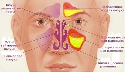 Hirudotherapy при заболявания на ушите носа-гърлото