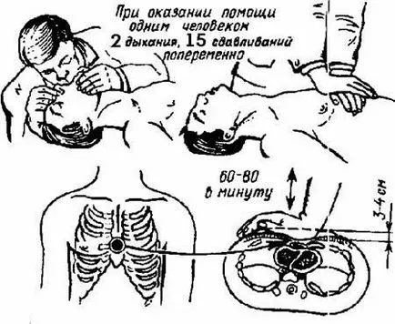 Cum CPR - Primul ajutor