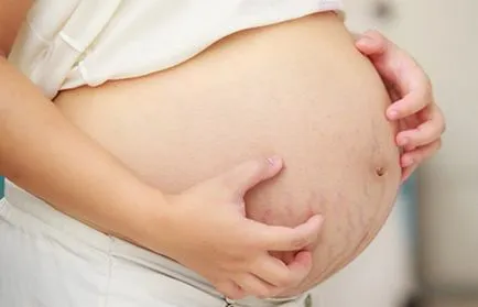 Как за лечение на дерматит по време на бременност