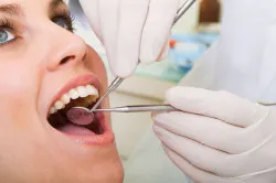 Cum de a opri sângerarea după extracția dentară