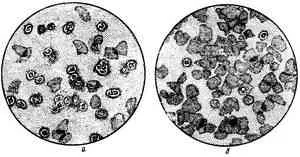 Coleitis kor - Szülészet - cikkek Directory - nők egészségét és nőgyógyászat