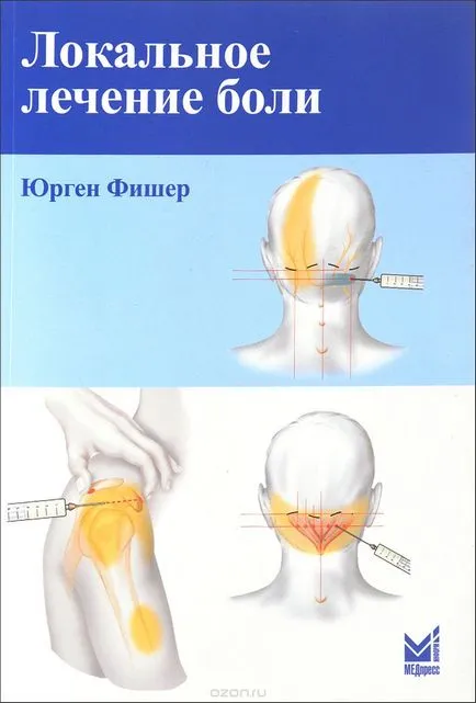 Tratamentul local al durerii Jürgen Fischer