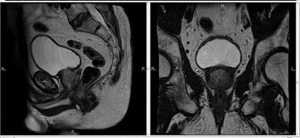 MRI на органите на малкия таз при жените в Москва цените на контраст, акции