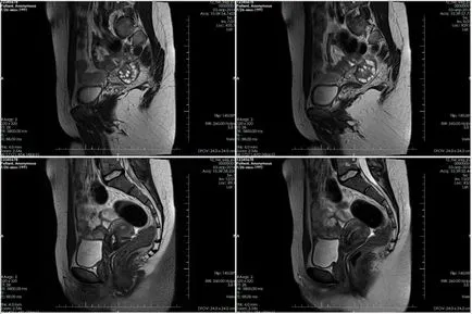 MRI на органите на малкия таз при жените в Москва цените на контраст, акции