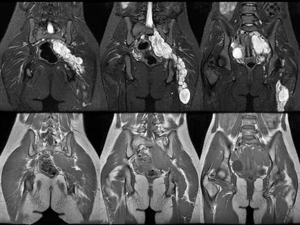 MRI на органите на малкия таз при жените в Москва цените на контраст, акции