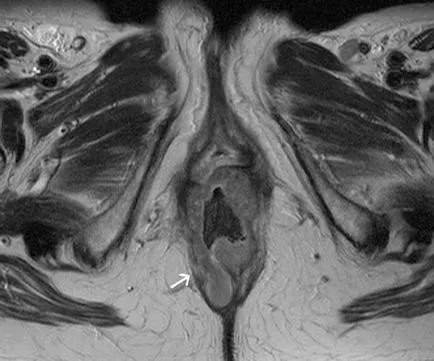 MRI на органите на малкия таз при жените в Москва цените на контраст, акции