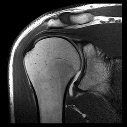 MRI на ставите в ревматология, травматология, ортопедия