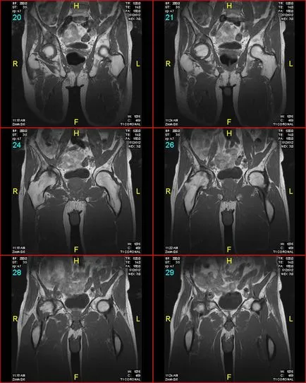 MRI на ставите в ревматология, травматология, ортопедия