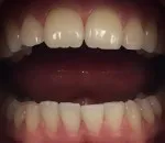 Vélemények a fogászat, „Mr. dinasztia”