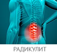 Osteochondrosis a férfiak, a tünetek (jelek) betegségek a nyaki és ágyéki gerinc és annak kezelése