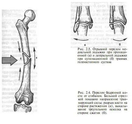 fracturi osoase - fracturi si leziuni osoase - chirurgie și tratament