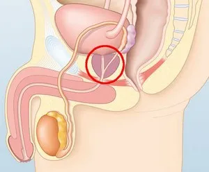 Причини за възникване на простатит и как да го избегнете