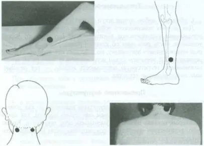 Használata akupunktúrás kezelésére hyperthyreosis és golyva