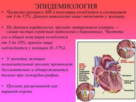 Пролапс на митралната клапа по време на бременност и раждане - симптомите 1, 2 градуса