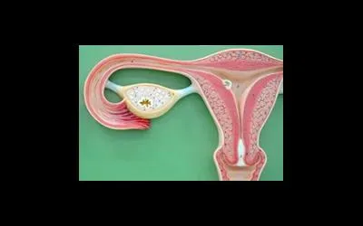 Dimensiunile fibrom uterin 11, 6, 7, 15, 4, 13, 16, 6, 5, 14, 10 săptămâni