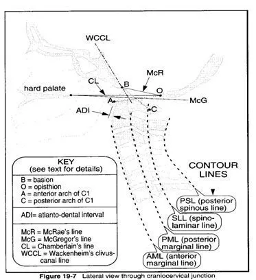 nyaki spondylograms