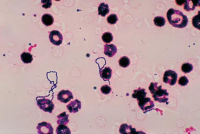 Streptococcusok (Streptococcus)