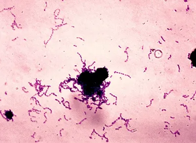 Streptococi (streptococcus)