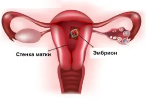 Sötét mentesítés menstruáció előtt 🍀 (barna) - az elején a menstruáció okai