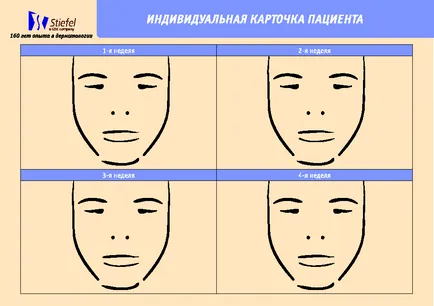 Acne, acne vulgáris, akne okai, kezelése Volgograd