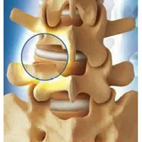 Vertebrology - mitikus tudomány