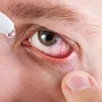 Mentesítés a szemét - okai és tünetei