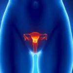 Chimioterapia pentru cancerul de col uterin eficacitate, pret, recenzii