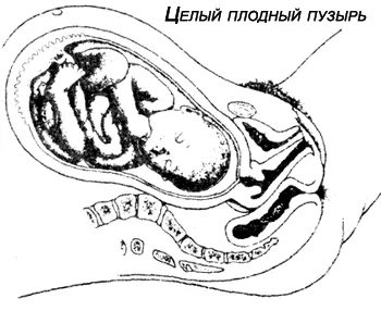 Аутопсия на мембрани - премахване на пречките или защитата на