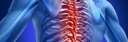 Osteocondrozei a coloanei vertebrale toracice cauze, simptome, tratament