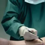 Amputáció a láb cukorbetegség (eltávolítása egy ujj)