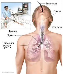 Bronchoszkópia Cseljabinszk - tanulmány a hörgők és a gége