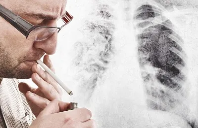 Rănit plămâni după fumat, de ce și ce să facă atunci când am renuntat la fumat, curățare pulmonar