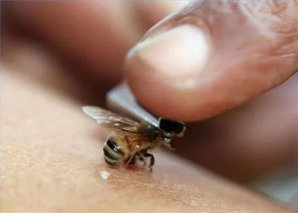 Какво да се прави и как да се избегнат ухапвания от пчели, оси и стършели първа помощ и интересни факти от клипа