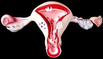 Difuz simptome adenomiozei uterine și tratament