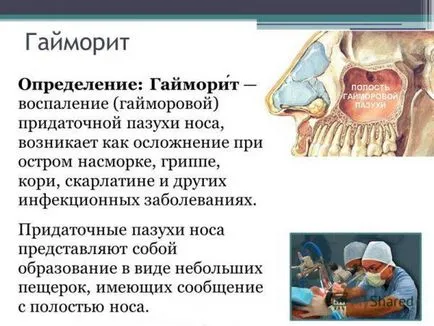 Двустранно синузит лечение на катарална, гнойна дома uslvoiyah народни средства за защита,