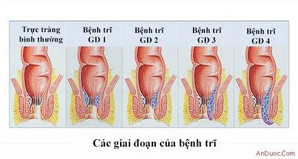 хемороиди духовността