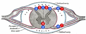 Accident vascular cerebral ischemic - tablou clinic