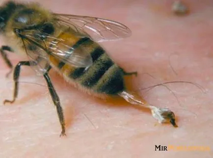 Cum pentru a evita înțepături de albine și ce să facă în cazul în care mușcat de o albină