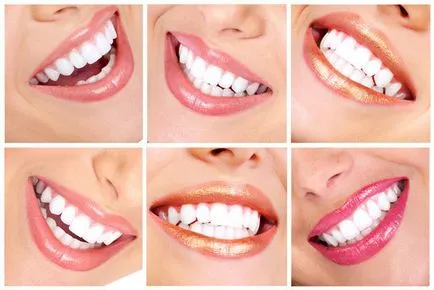 Cum de a restabili smaltul dintilor la domiciliu, dinții noștri