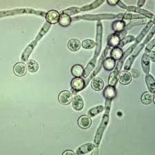 nyelőcső-candidiasis vagy candida oesophagitis