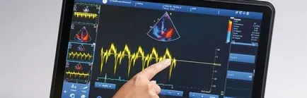 Miért ultrahang készülék hangjelzést ad, és hogyan lehet megoldani a problémát