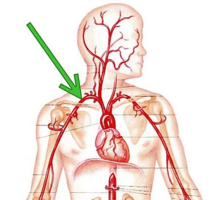 субклавиална артерия
