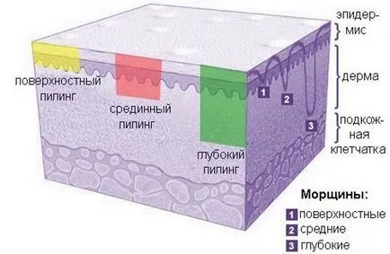 peeling chimic ușoare se confruntă acasă