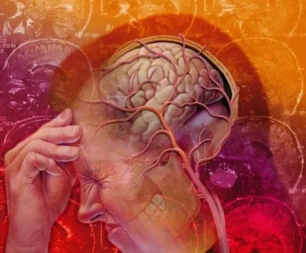 Migrén jelek, tünetek, okok, kezelésére és megelőzésére migrénes fejfájás