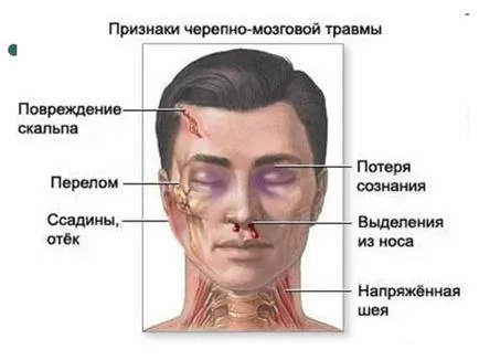 Последствия и усложнения след сътресение