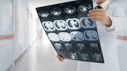 MRI предавания и разглеждане на забележителностите, че много по-различни от контраста