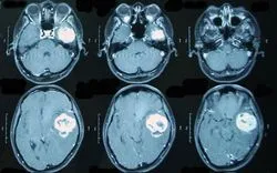 MRI предавания и разглеждане на забележителностите, че много по-различни от контраста