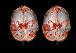 MRI предавания и разглеждане на забележителностите, че много по-различни от контраста